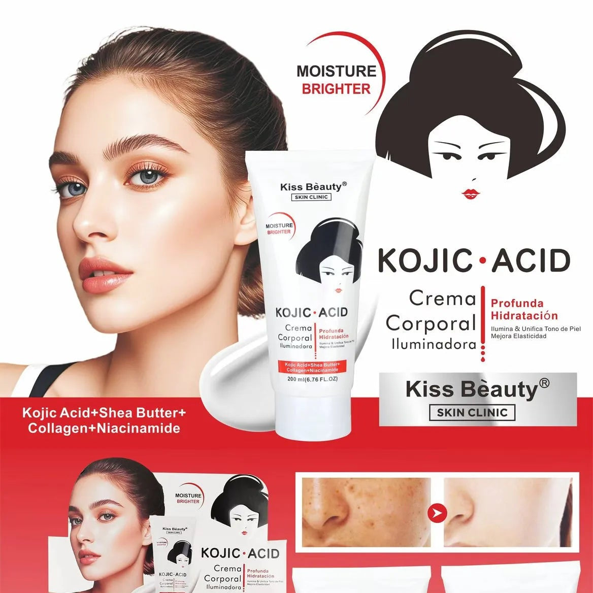 CREMA CORPORAL ACIDO KOJIC